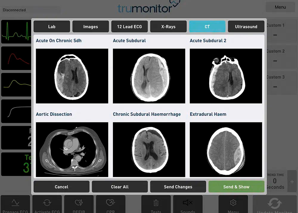 TruMonitor App CT Screenshot