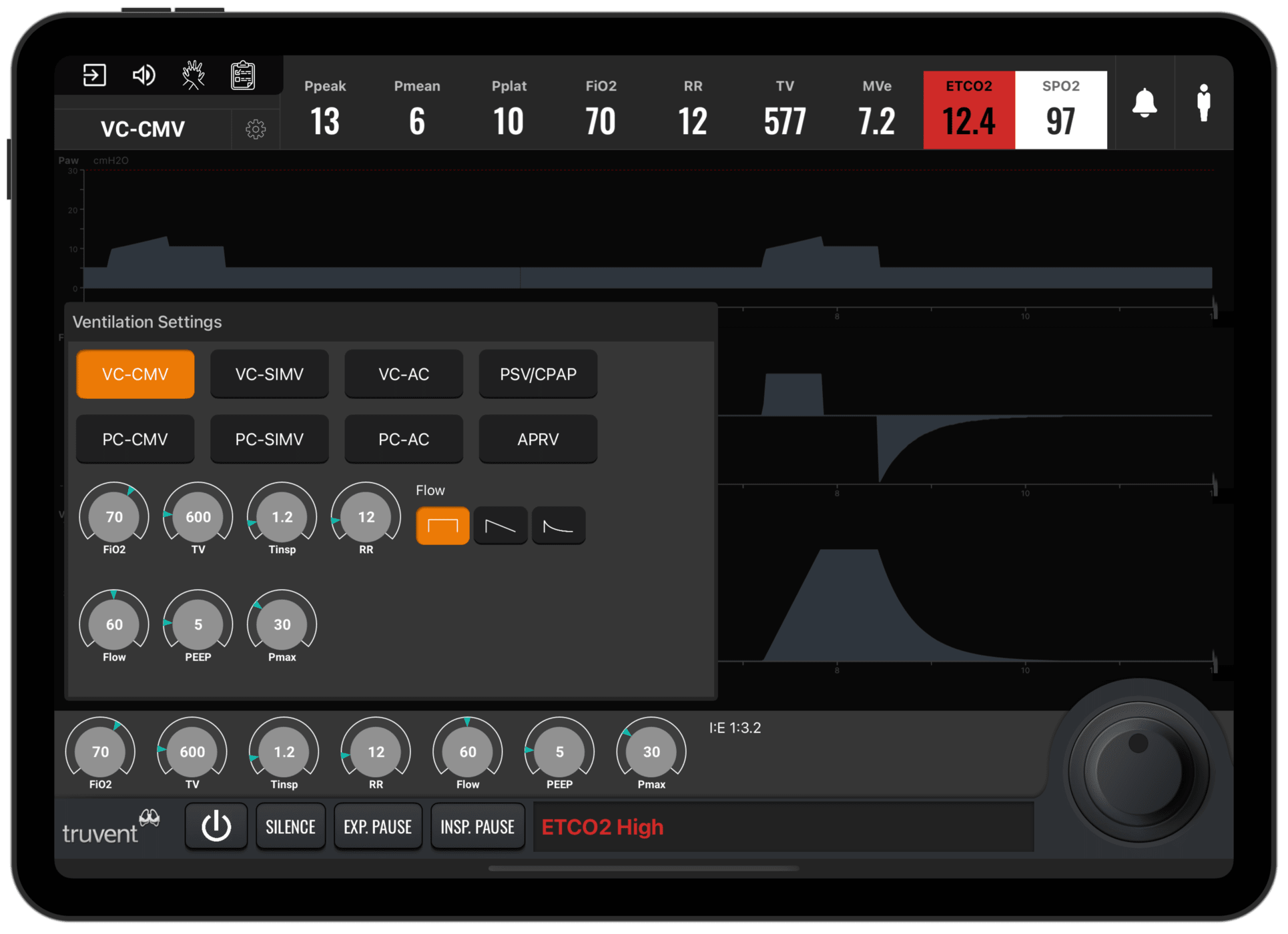 TruVent: Мастер механической вентиляции | Приложение Симулятор