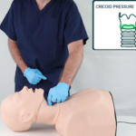 Smart Airway Adult - Cricoid Pressure