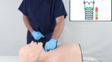 Smart Airway Adult - Cricoid Pressure