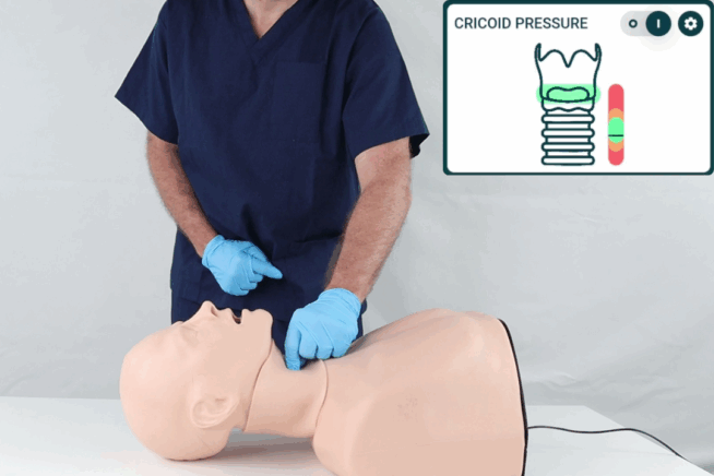 Smart Airway Adult - Cricoid Pressure Smart Airway Adult - Cricoid Pressure