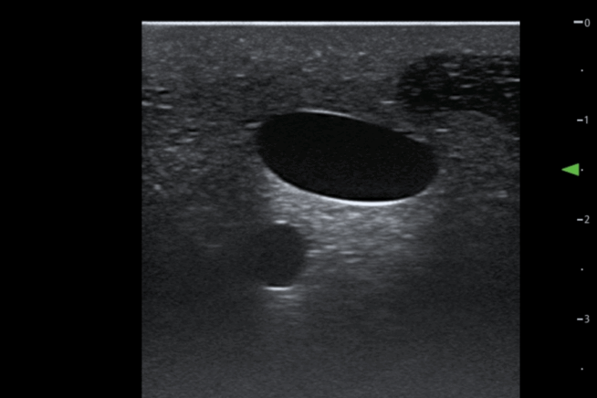 TCVC100 - TruCVC Ultrasound Imagining (3) TruCVC Ultrasound Imaging