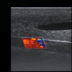 TCVC100 - TruCVC Ultrasound Imagining (7)