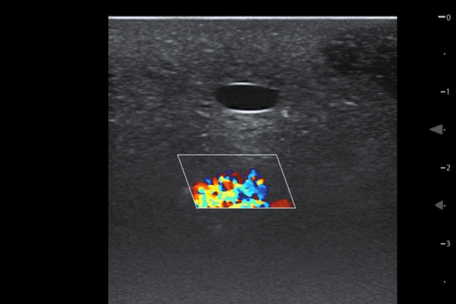 TCVC100 - TruCVC Ultrasound Imagining (8) TruCVC Ultrasound Imaging