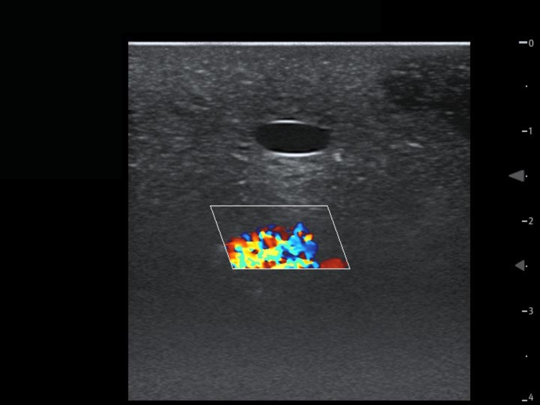 TCVC100 - TruCVC Ultrasound Imagining (8)