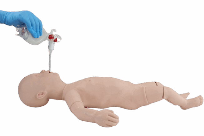 Infant Endo-tracheal Tube Intubation Infant Endo-tracheal Tube Intubation