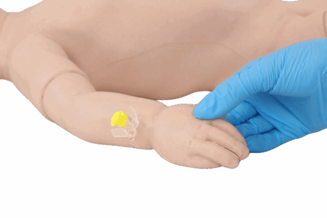 Infant Peripheral Venous Cannulation Arm Infant Peripheral Venous Cannulation Arm