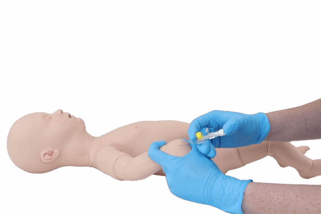 Infant Peripheral Venous Cannulation Hand Infant Peripheral Venous Cannulation Hand
