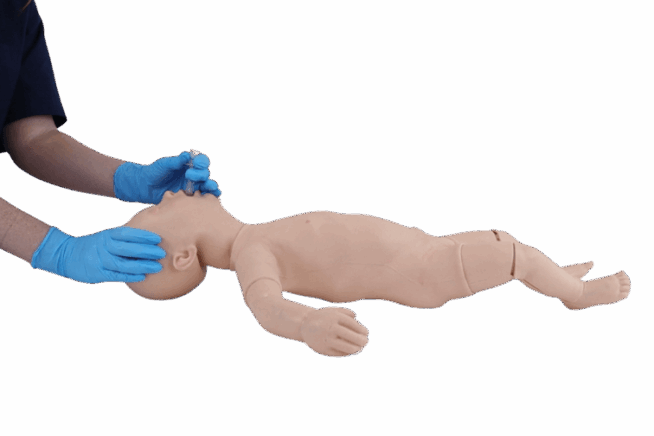 Infant Supraglottic Device Insertion Infant Supraglottic Device Insertion