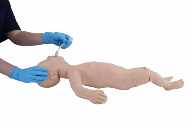 Infant Supraglottic Device Insertion iGel Infant Supraglottic Device Insertion iGel