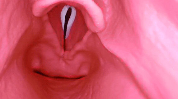 Trucorp's Difficult Airway internal airway.