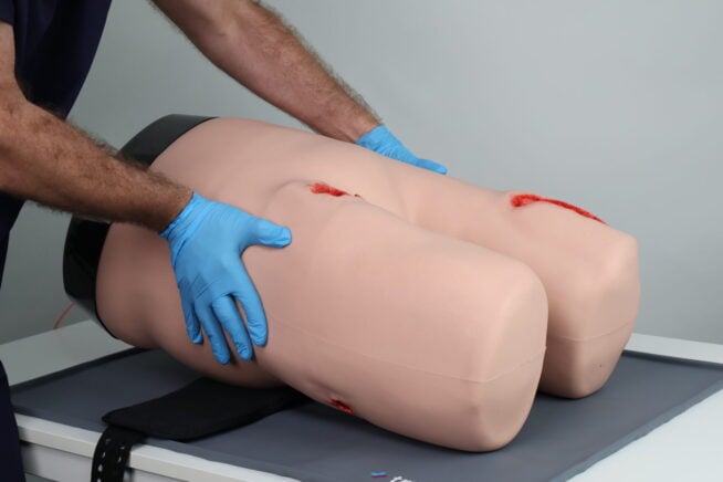 IMG_8369 Stab wound on mid-thigh with bleeding.