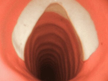 Adult Airway 3 Adult Airway 4