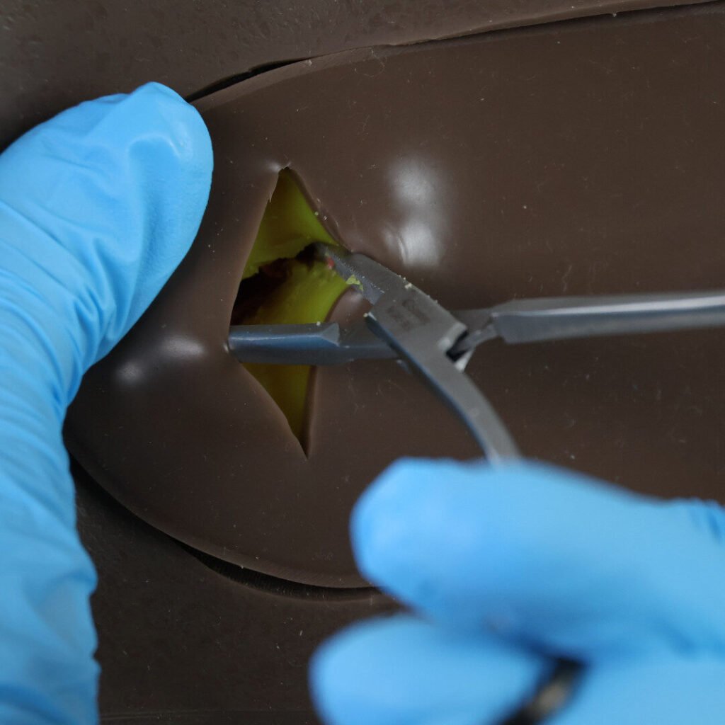 Chest Drain incision